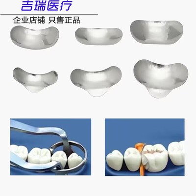 牙科豆瓣成型片补充片多型号口腔不锈钢新型补牙豆瓣夹100片一包