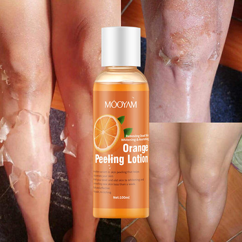 橙皮乳液脱皮油身体乳温和去角质啫喱凝露Orange Peeling Lotion