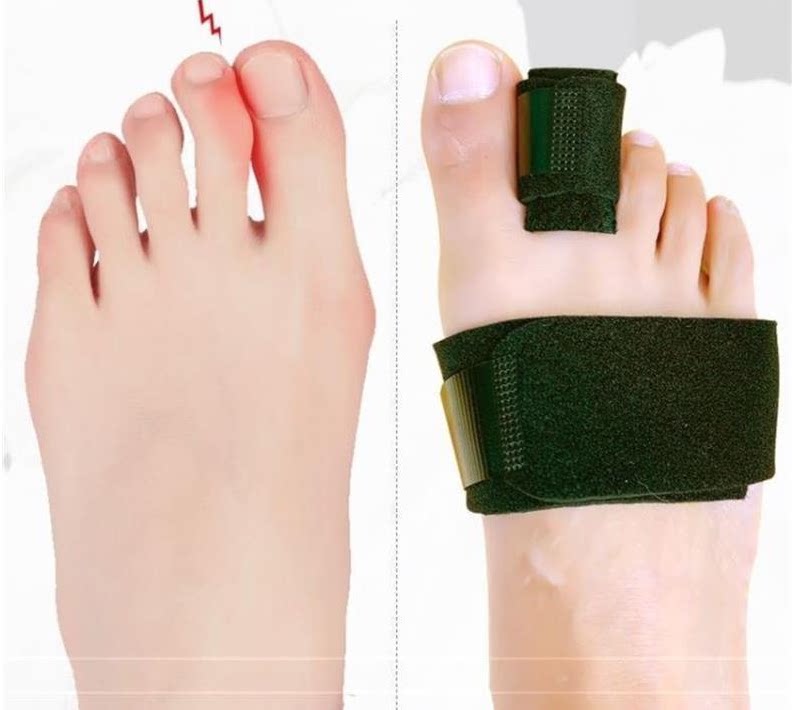 大小脚趾骨折固定器拇指外翻矫正足趾脱受伤臼支具夹板脚套可下地