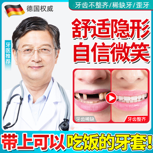 牙套可吃饭神器专通用临时遮丑美白缺门牙老人全口假牙齿套仿真x