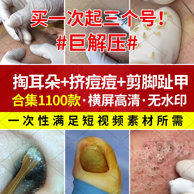 挤痘痘青春痘粉刺脸部清洁助眠采掏耳朵垢修脚趾舒缓解压视频素材