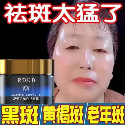 点斑专用药水美容院点痣膏