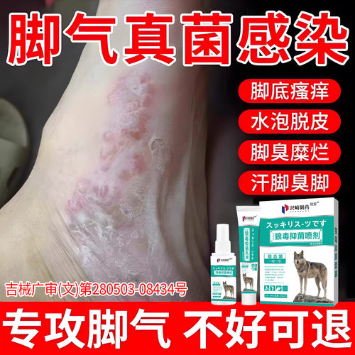 【脚气喷雾】远离足部问题