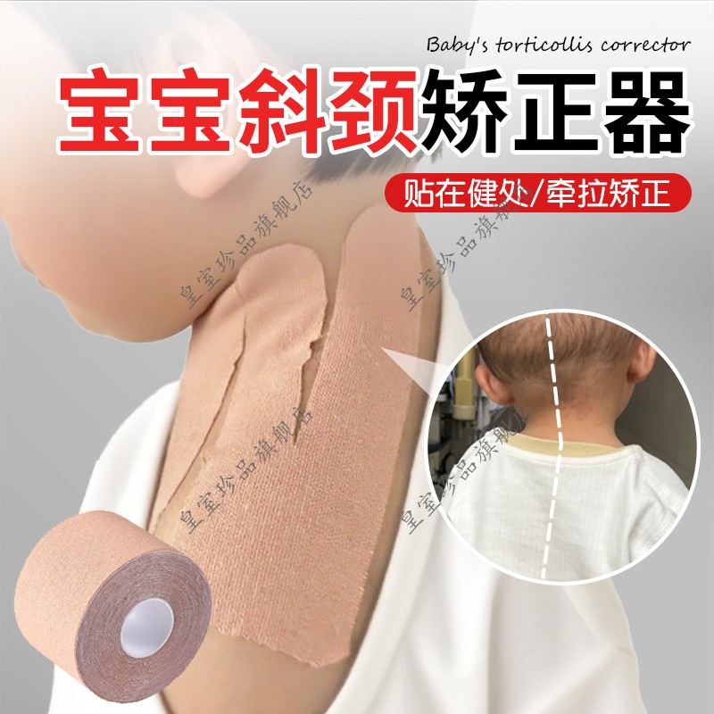 宝宝斜颈矫正器儿童婴幼儿颈托歪脖子头型纠正伸器偏头歪头护颈