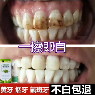 牙齿美白速效去除黄牙烟渍氟斑牙洗牙液去黄污垢变白药水专用神器