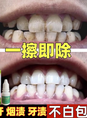 【一擦即除】黄牙烟渍茶渍牙垢