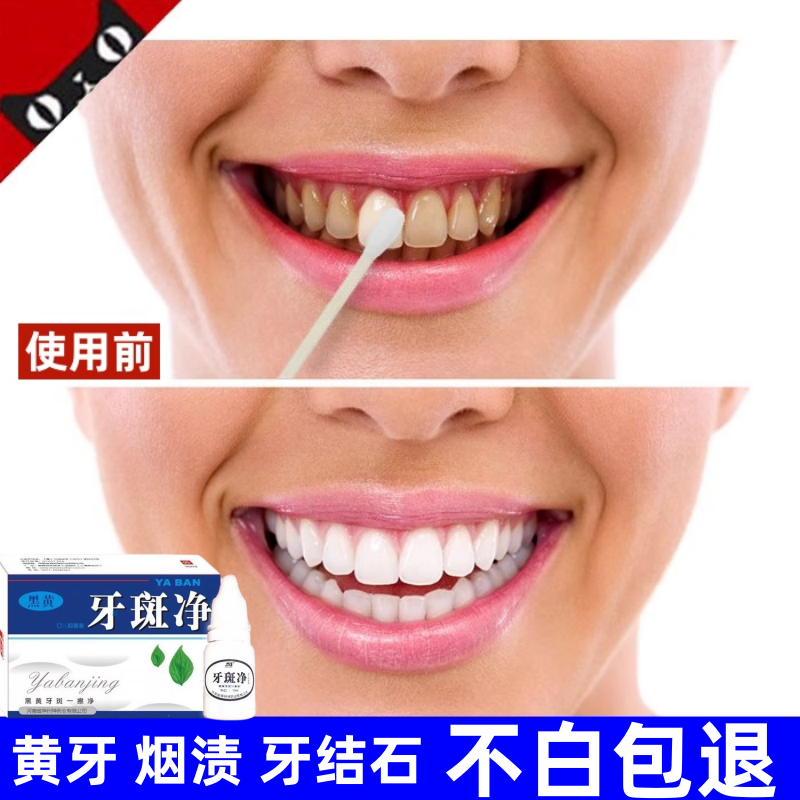 强力去烟渍牙膏去渍去黄去口臭美牙膏