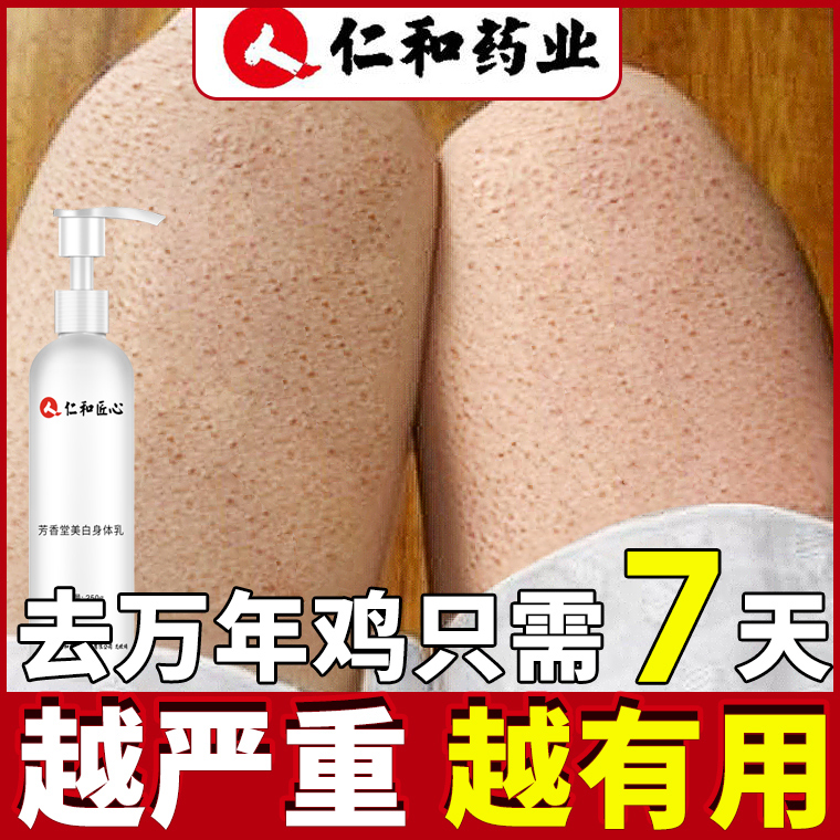 果酸美白保湿去鸡皮肤疙瘩毛囊角质角化全身体乳去除女夏男士