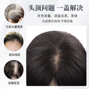 琪姐小面积补发片头顶增发量遮白发蓬松高颅顶随意分轻薄款全真发