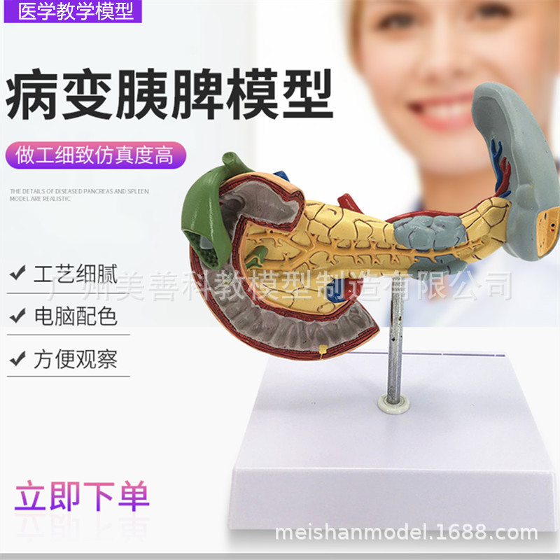 教学仿真病变胰脾肝胆十二指肠模型病理胰腺标本人体器官解剖医学