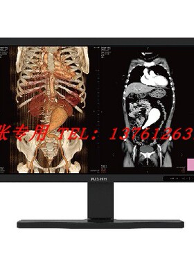 仙艺康冠6MP RX660医用显示器放射诊断内窥镜30寸艺卓EIZO GX560