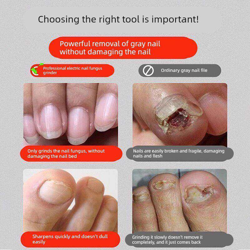 灰指甲打磨器电动磨甲器修脚刀专用套装工具挫灰修脚趾甲修剪神器