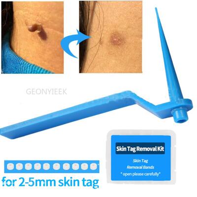 1 Set Skin Tag Kill Skin Mole Wart Remover Micro Skin Tag Re