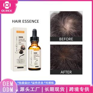 Hair OUHOE and Thicker Stronger for Scalp Essence