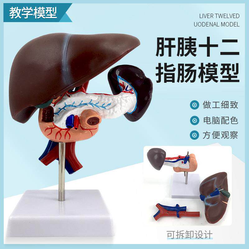 肝胰十二指肠模型肝、脾、血管和胰腺结构模型肝脏脾胰腺模型
