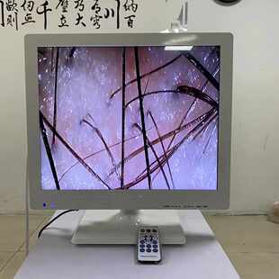 便携式 17寸带美容仪存储对比格头皮检测仪测试养发毛囊毛发分析