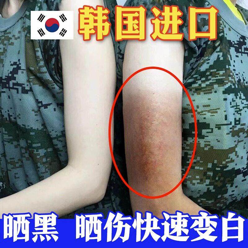 晒黑了皮肤晒伤晒后军训修复黑怎么快速霜女士男士乳面部