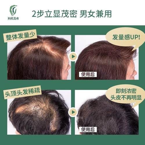高档日本利尻昆布增发型维+定喷雾发际线假发粉补发增纤发密发神