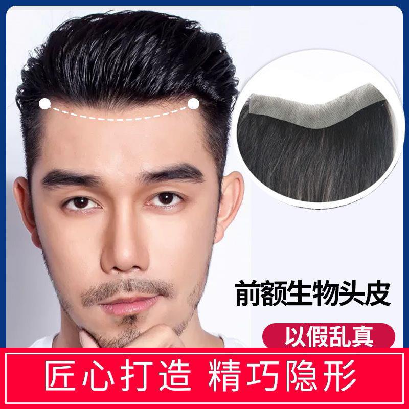 发际线假发贴男士前额真发补发片假浏海男隐形生物头皮M型假发片