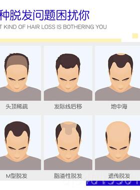 高档木极客侠假男无痕隐形补制发际线男士定真发发头假发顶片补发