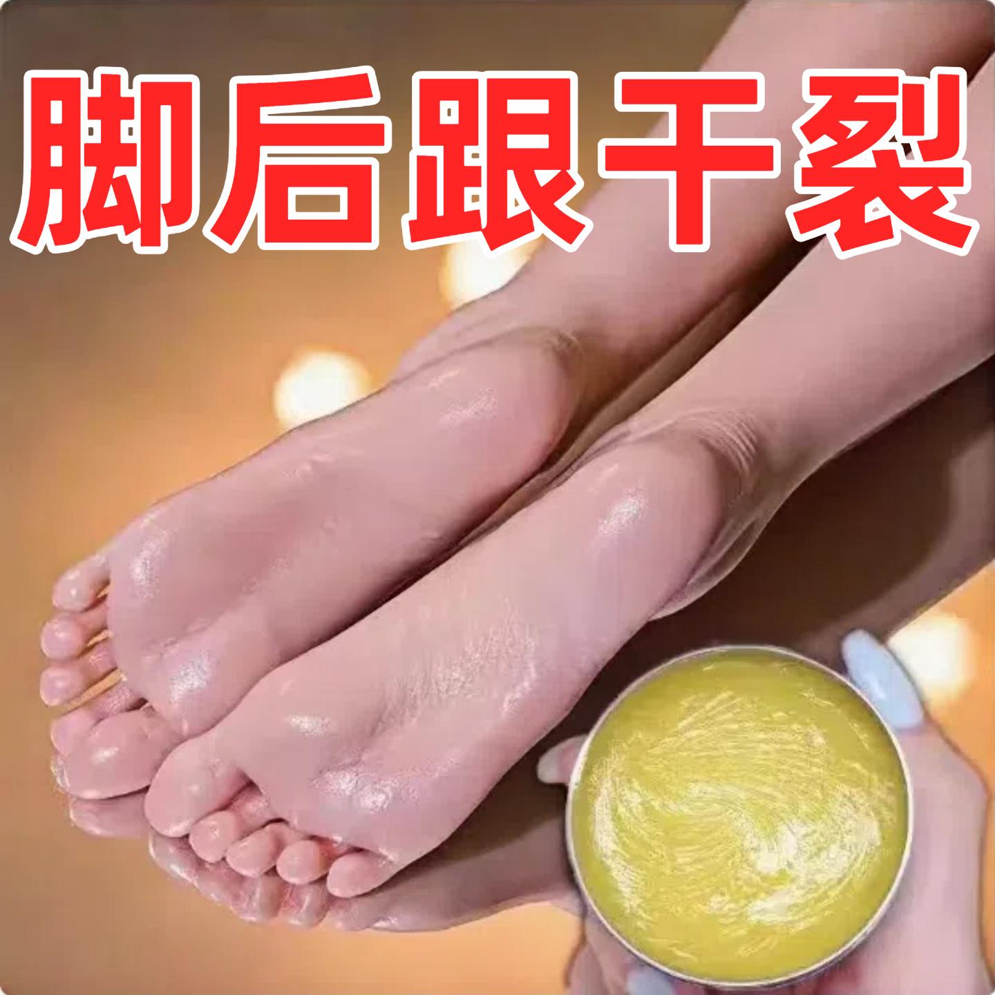 皴裂膏凝露滋润防足裂干燥保湿跟手足干裂膏防裂膏官方旗舰店正品