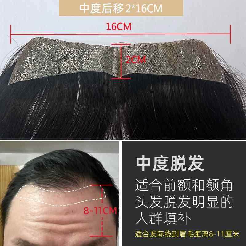 正品发线刘男假发贴男士前额痕可修剪发型真人际发丝隐无形M型额