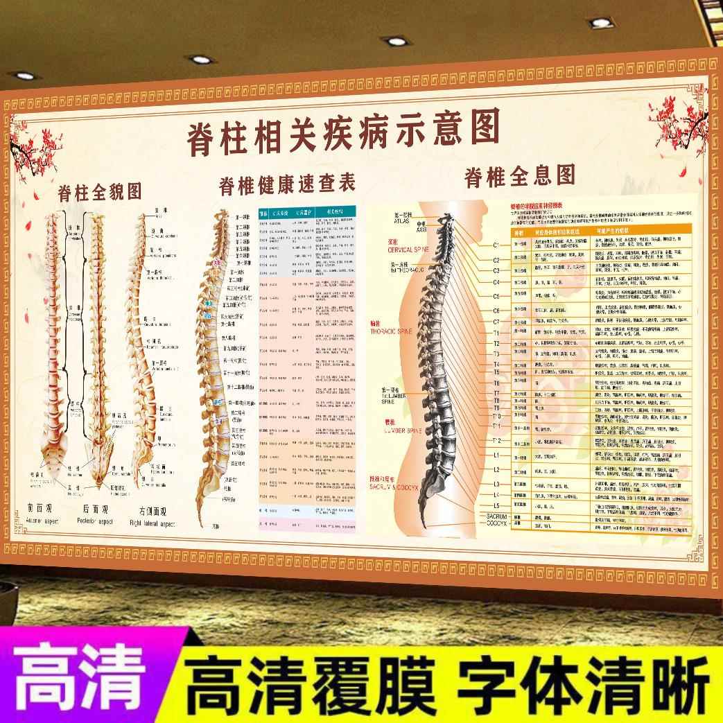 脊柱脊椎相关疾病示意图脊椎腰椎引起的病症画理疗养生馆正骨挂图