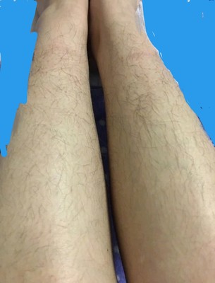 蒂丝脱毛仪怎么样?用我的使用经历告诉大家真相