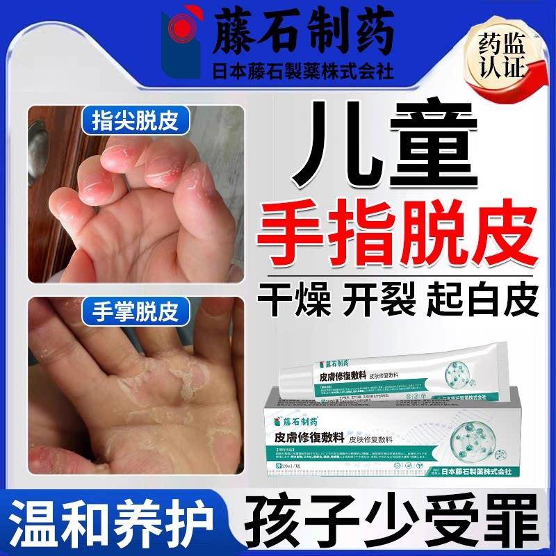 儿童手足脱皮膏手指脚掉皮专用小孩子季节性手严重蜕皮药房同售SK