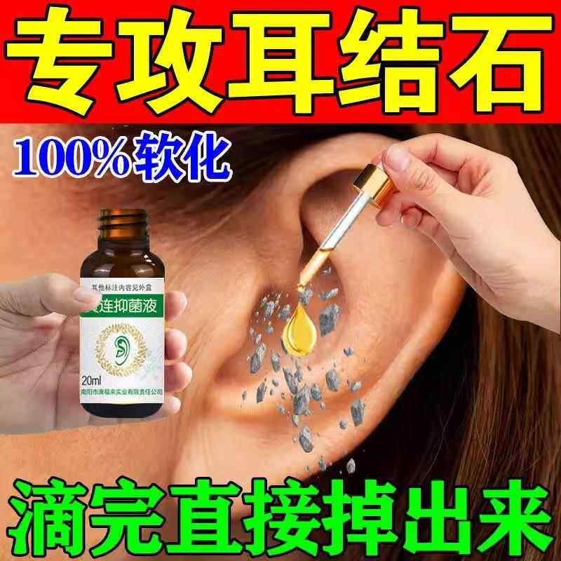 耳结石软化水滴耳液软化耳屎耳朵止痒抑菌洗耳朵的药水取耵聍神器