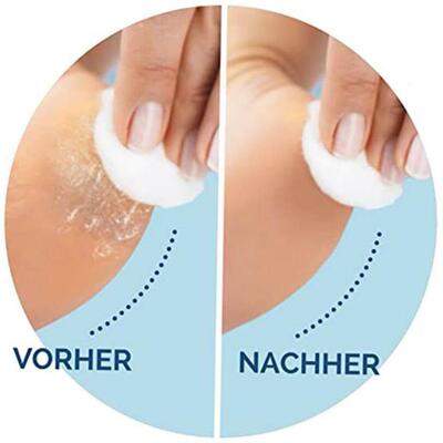 Foot Care Tool Electric Foot File Foot Callouses Dead Skin