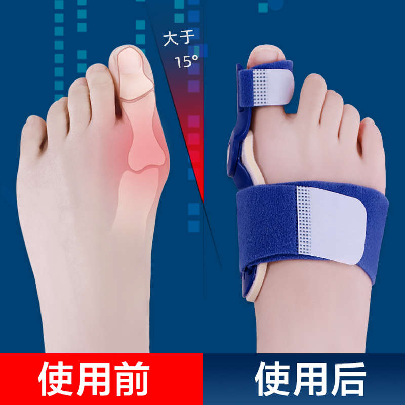 拇指外翻矫正器拐骨脚趾内翻矫形大脚骨母趾头男女纠正带可以穿鞋