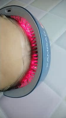 HairMax41激光生发仪怎么样?用着好不好呢?说真心话