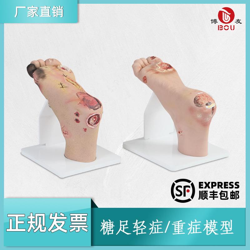 tnb足护理模型工具pvc模具老年人脚部训练设备hs19