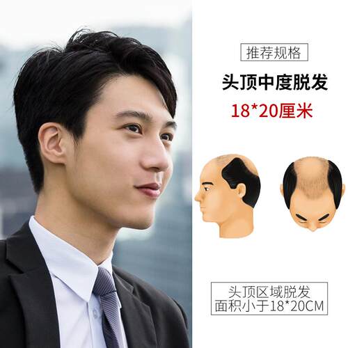 高档真男士假发短补发帅气韩版头顶发片偏分秃前额中老年男式发补