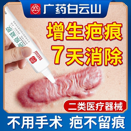 祛疤膏手术烫伤疤痕淡化剖腹产凸起瘢，疙瘩增生去除去疤膏修复除疤