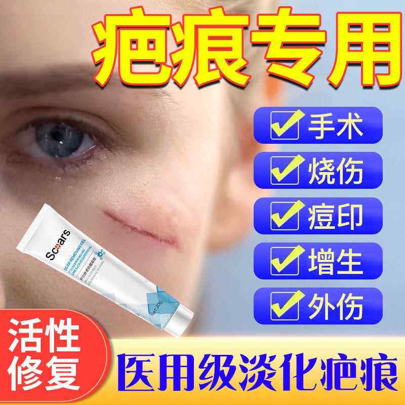 淡疤膏疤痕增生剖腹产修复无痕妊娠纹印去痘疤神器