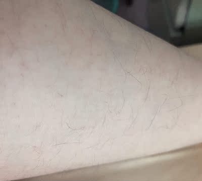 飞利浦lumea脱毛仪bri864家用怎么样？多人被骗了？事件真相是？