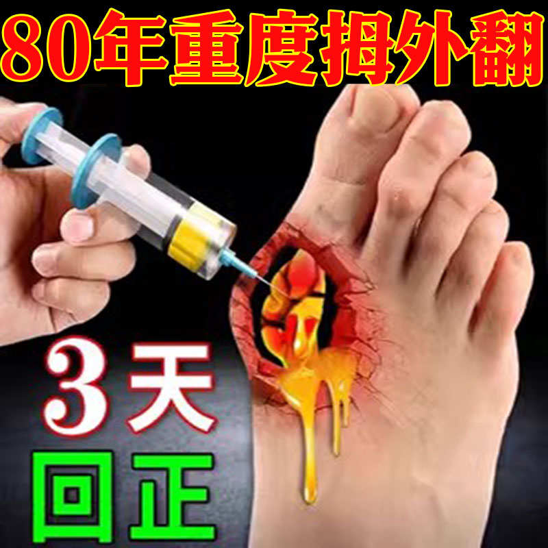 【50年大脚骨一夜直】拇指外翻膏贴拇外翻肌贴大脚骨脚趾矫正器