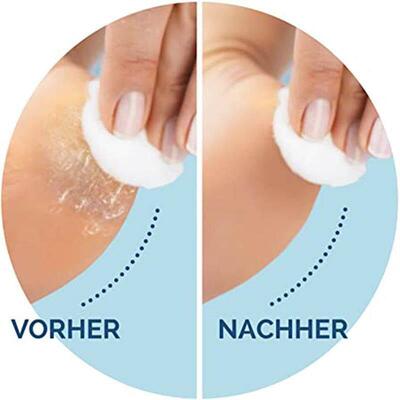 Foot Care Tool Electric Foot File Foot Callouses Dead Skin R