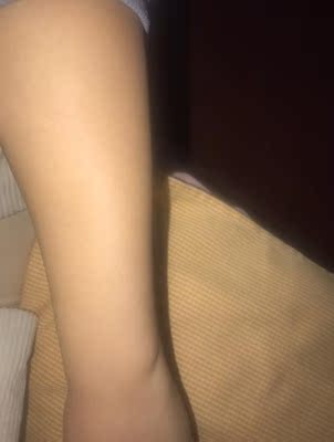 伊苼美脱毛仪激光冰点仪器家用怎么样？会不会问题很多？