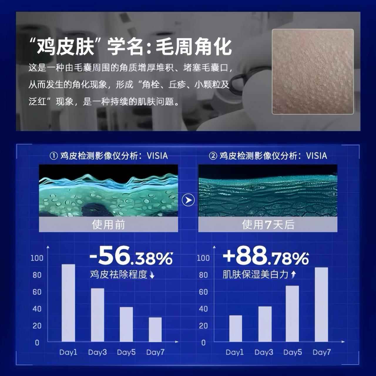 果酸身体乳保湿润女皮肤干燥秋冬持久滋留香去鸡皮生素维肤BSQG5