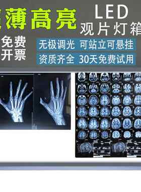 X光阅片灯CT核磁骨科看片灯led观片灯箱牙科双三联超薄医用观片灯