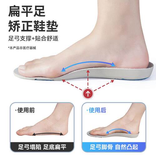 Orthotic Arch Support Insoles 足弓矫正支撑扁平足内八字鞋垫