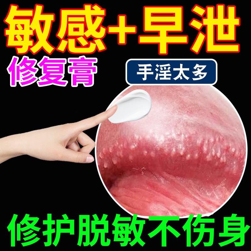 脱敏器膏鬼头龟头敏感男士脱敏治疗早泄训练降敏药膏贴喷雾时间短