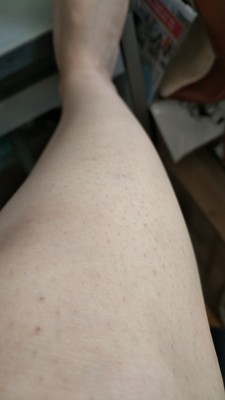 蒂丝脱毛仪怎么样?用我的使用经历告诉大家真相