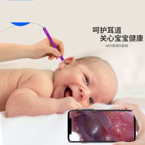 耳勺内窥镜掏耳清洁器可视洁耳器