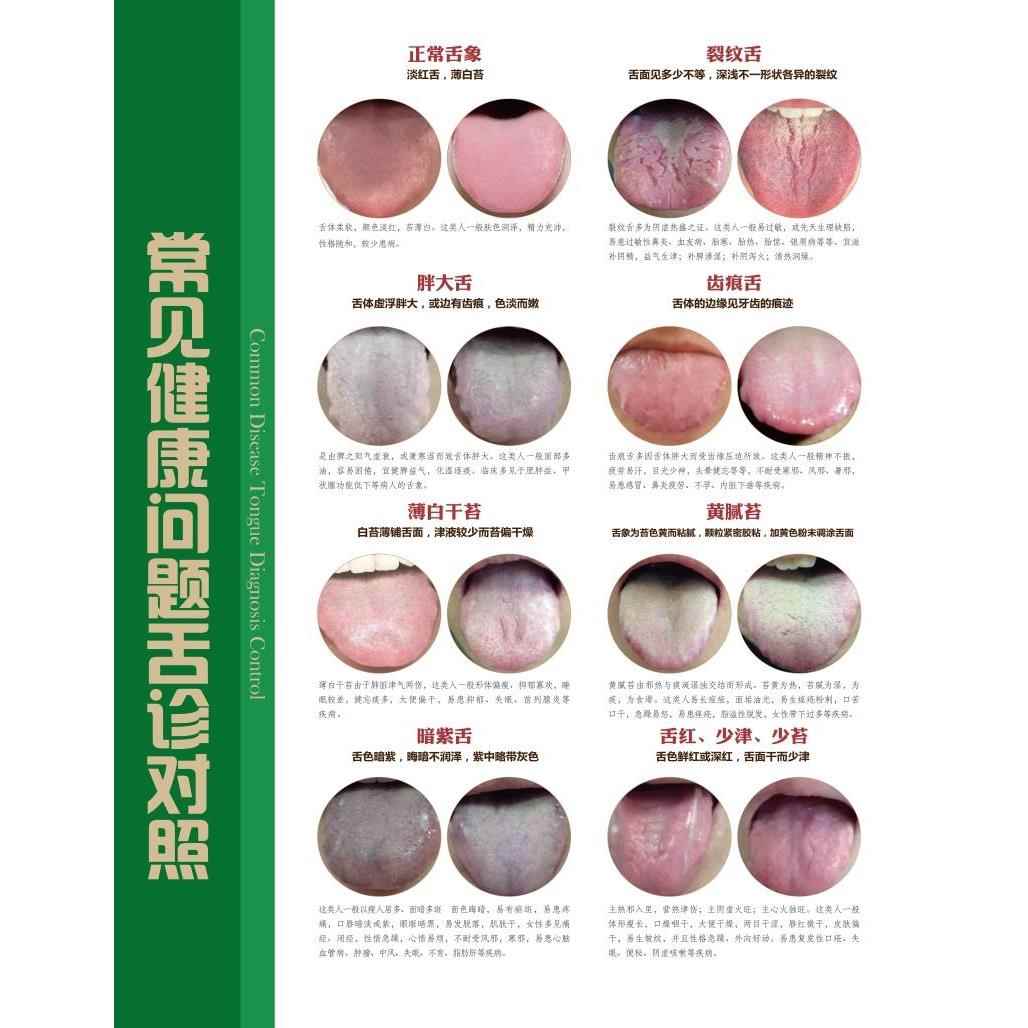 常见健康问题舌诊对照海报展板舌诊基础知识挂图装饰画墙贴墙纸