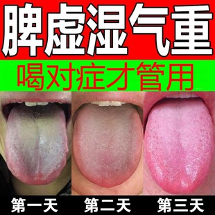 健脾祛湿调理脾胃去体内湿气热寒湿养生茶茯苓养胃除湿疏肝去湿气