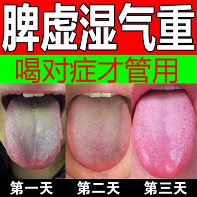 健脾祛湿调理脾胃去体内湿气热寒湿养生茶茯苓养胃除湿疏肝去湿气